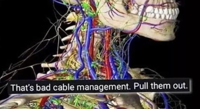 a 3D model of a human neck with arteries, veins, lymph nodes, and nerves, shown all clumped and tangled together, labeled "That's bad cable management. Pull them out."